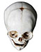 Lebka a obratle - Skull and vertebrae